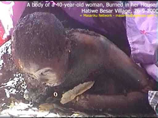 burnt body of a woman
