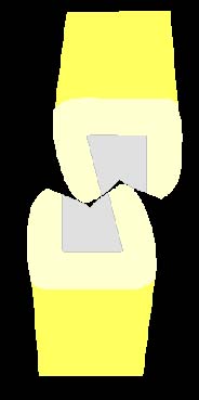 Convergence of proximal walls also provides retention