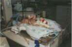 After 1st surgery 1 Month