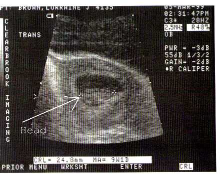 /user/ultrasoundmar5.jpg