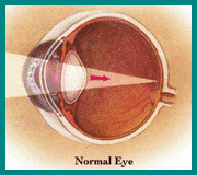 hippus pupil in one eye hippus pupil in one eye
