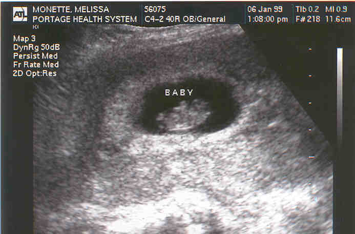 dating scan date change Our nhs sonographer changed our due date at 12 weeks even if you genuinely believe that 39 weeks by scan dates is earlier than you want. dating scan date change Our nhs sonographer changed our due date at 12 weeks even if you genuinely believe that 39 weeks by scan dates is earlier than you want.