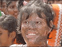 acid victim