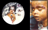 child deaths