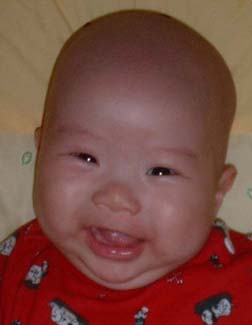 A Baldie