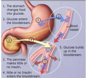 Medicine Acupuncture Herbal Treatment Cure Diabetes Herbs Kuala Lumpur Medical Treatment Cure Centre