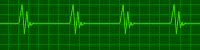 kardiograma.gif (15837 bytes)