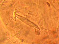 Genus nov. sp. nov. (Collembola) from the UK
Female sub anal appendage
2009.05.20 © Janssens, F.
Det. Greenslade, P.