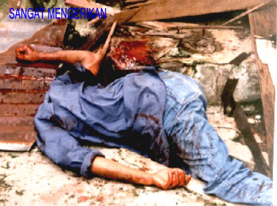 Headless Body