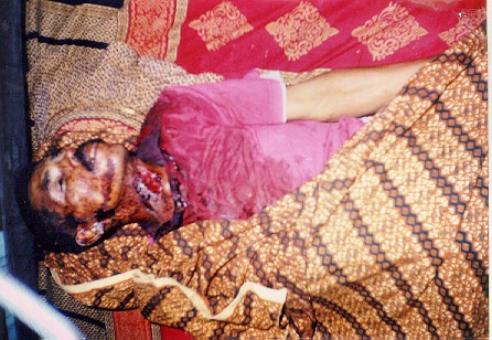 Hulaliu's victim