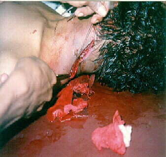 shooting victim