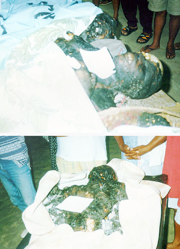 Burned Corpses