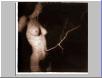 Umbilicus