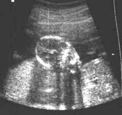 ultrasound2