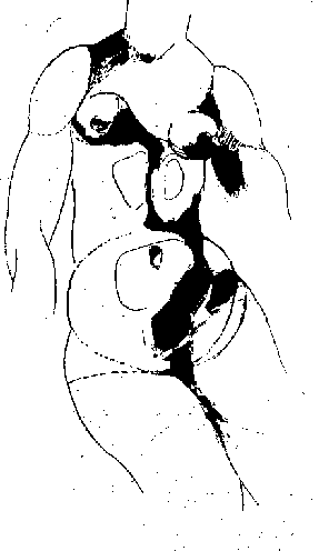pear