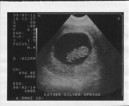 9 Weeks