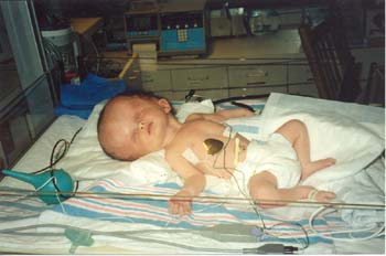 nicu