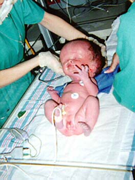 nicu3
