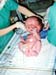 nicu3