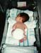 nicu5