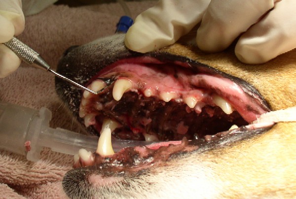 Gauging tool shows a shallow pocket of gingival detachment