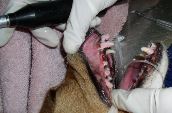 Polishing the teeth