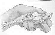 Hold