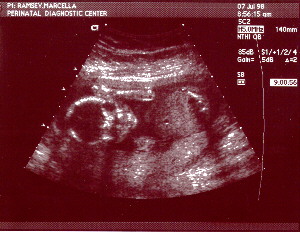 19 weeks 3 days