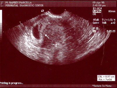 7 weeks 0 days