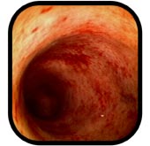 The IBD Sufferers Webring's Previous
           Website