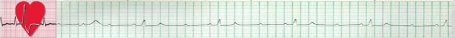 EKG Border
