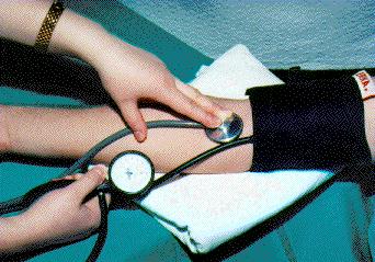 Ses duyuluyor,manometre yaklak 160 mmHg'y gstermekte