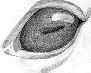 Horse's eye