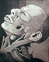 Cadaver 1