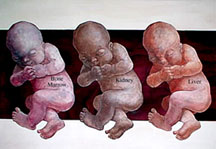 Donors