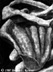 To The Bone, drawing  1987 Diane L. Keister. All Rights Reserved.