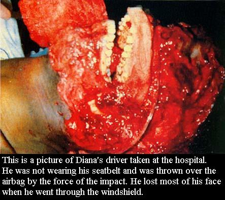  Diana's driver