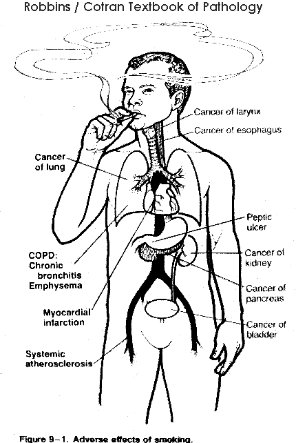 smokchrt.gif (19211 bytes)