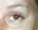eye