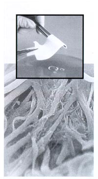 2-alloderm.jpg (20909 bytes)
