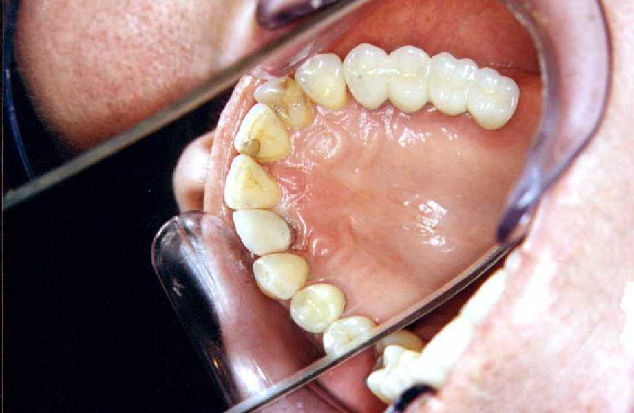 3impl.jpg (40008 bytes)