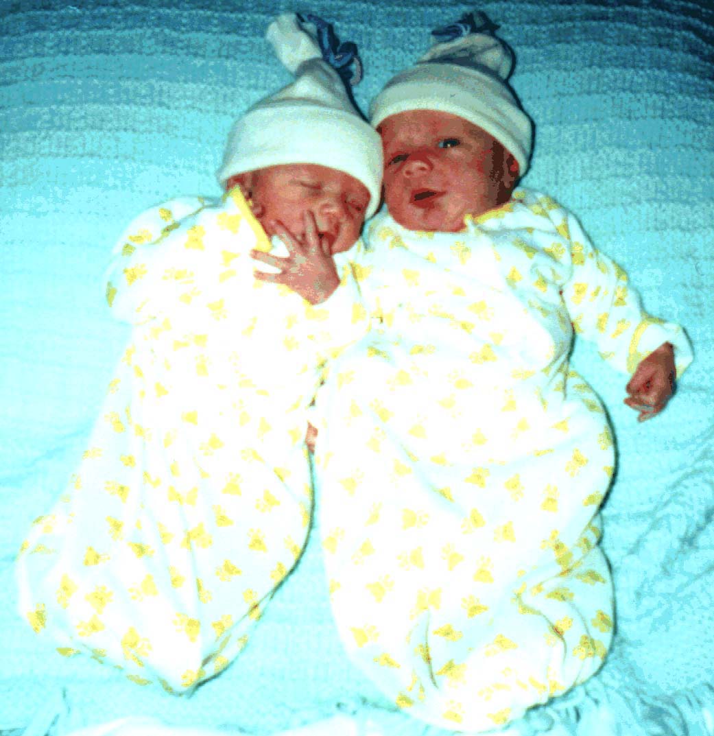 [Twin babies photo]