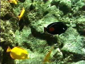 achilles tang