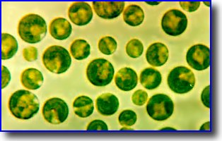 [Imagen ampliada del alga Chlorella, responsable del agua verde]