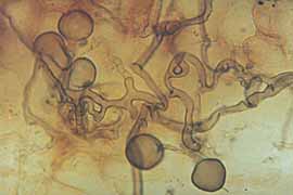  Esporas endo micorriza. Micro hongos, bacterias y las raices viven simbioticos para sobrevivir, anterior al organismo compuesto. Productos bioticos de ultima generacion corrigen la regeneracion bosque y enfermedades de las plantas con abonos vivos, extraidos de microbiotas ...