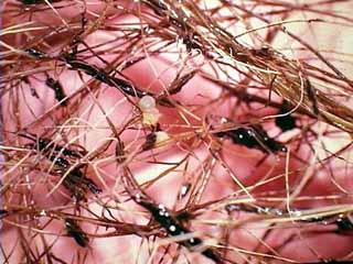Goldfish eggs