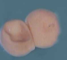platypus eggs