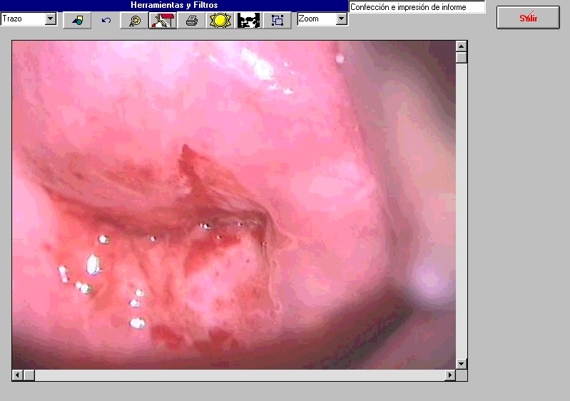 colpodoc2.jpg (78539 bytes)