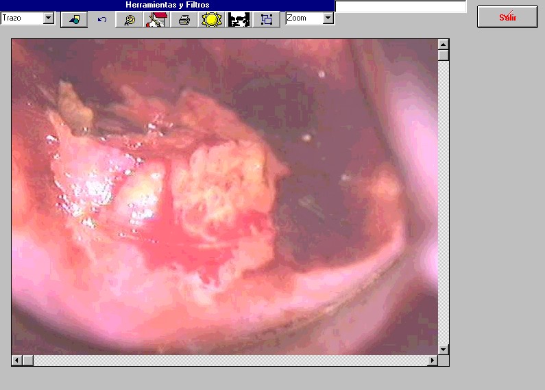 colpodoc3.jpg (82449 bytes)