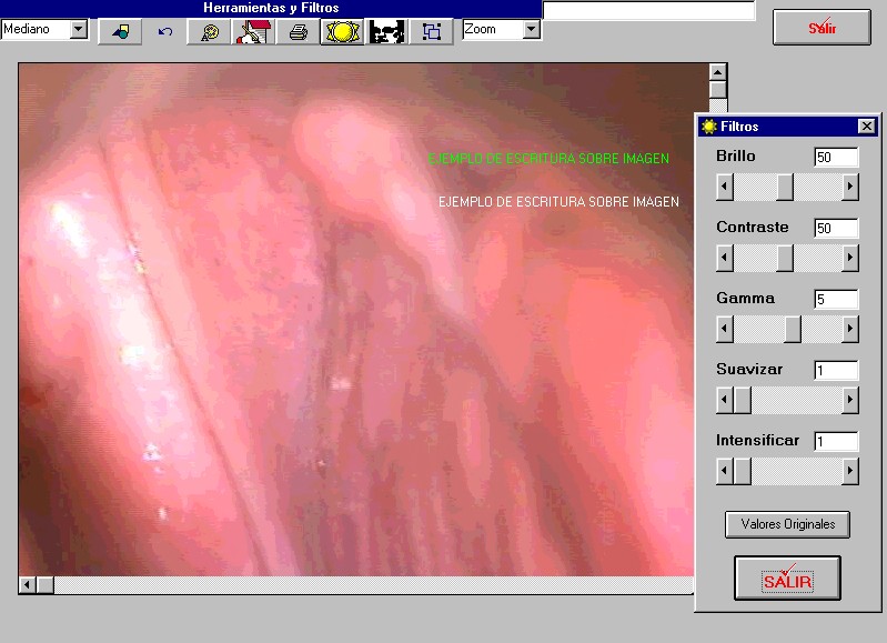 colpoescritura1.jpg (97251 bytes)